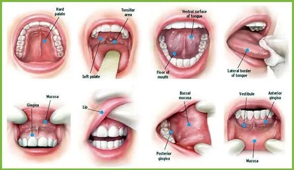 Oral Cancer Screenings